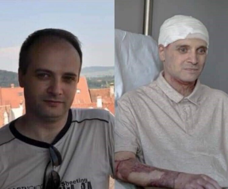 Medicul erou Cătălin Denciu s-a întors acasă, după 6 luni de tratament în Belgia