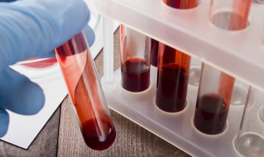 A fost descoperită o nouă grupă sanguină: se numește Er